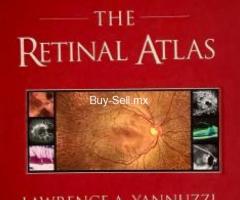 The Retinal Atlas de Yannuzzi